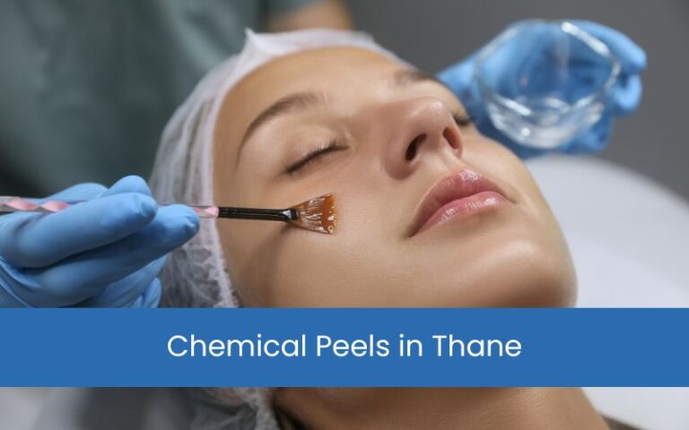 Chemical Peels in Thane