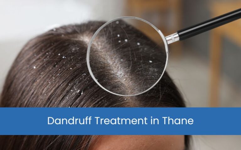Dandruff Treatment in Thane – Say Goodbye to Flakes with Expert Care