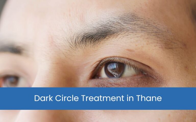Dark Circle Treatment in Thane