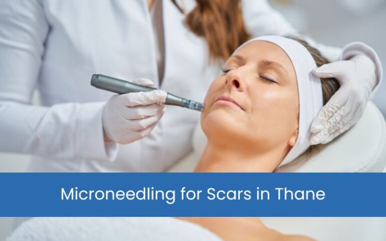 Microneedling for Scars in Thane