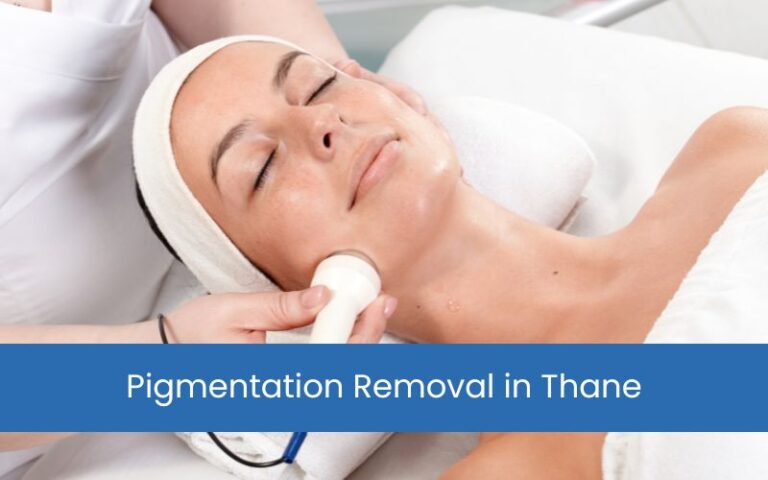 Pigmentation Removal in Thane