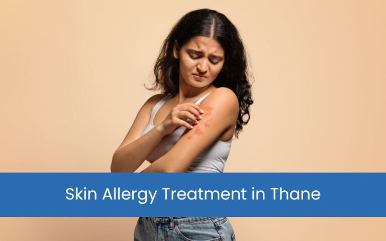 Skin Allergy Treatment in Thane – Personalized Care for Sensitive Skin