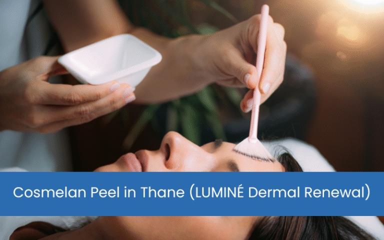 Cosmelan Peel in Thane (LUMINÉ Dermal Renewal)